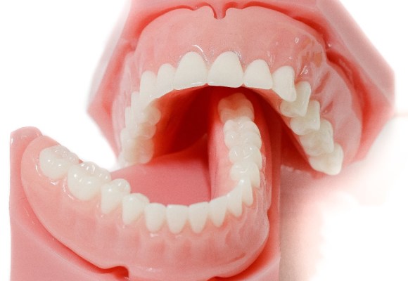 Dentures